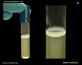 v.cholerae growth in liquid medium